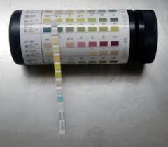 Urine Reagent Strips