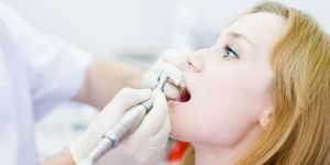 Teeth Scaling Services