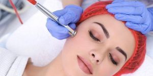 Microdermabrasion Treatment