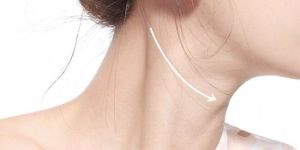 Neck Lines Treatment