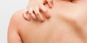 Skin Infection Treatment