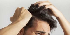 Telogen Effluvium Treatment