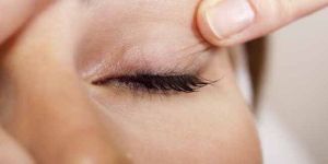 Xanthelasma Treatment