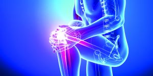 Orthopaedic Treatment