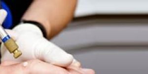 Cryotherapy Treatment Services