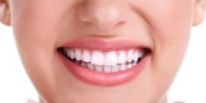 Smile Designing Treatment Services