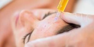 Vampire Face Lift Treatment Services