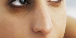 under Eye Treatment Services