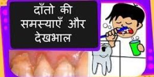 Dentist Chennai