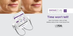 Advance Laser Treatment Services