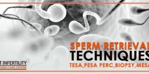 Tesa IVF Treatment