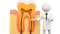 Root Canal Treatment
