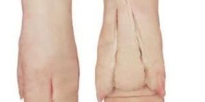 Frozen Pork Hind Feet