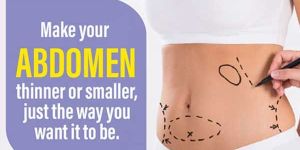 Abdominoplasty Treatment Services
