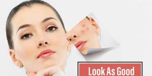 Abdominoplasty