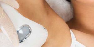 Laser Hair Removal Services