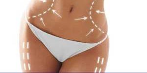 Liposuction Surgery
