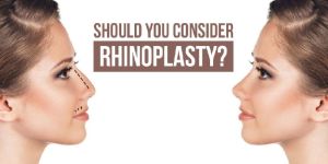 Rhinoplasty
