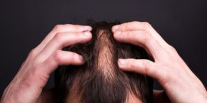 Non Surgical Hair Fixing Treatment