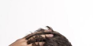 Non Surgical Hair Replacement Treatment
