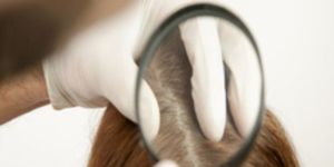Non Surgical Hair Weaving Treatment