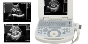 Portable Transducer Veterinary Ultrasound Scanner