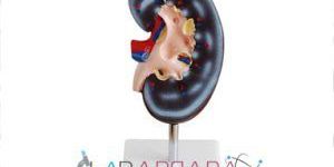 Kidney Model