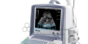 Digital Ultrasound Diagnostic Device
