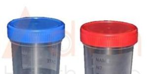 Urine Culture Bottle