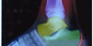 Universal Digital X Ray Film