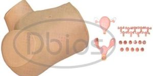 Gynecological Training Model