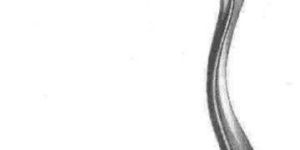 Sims Speculum