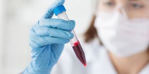 Blood Testing Services