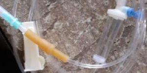 Infusion Set with Air Vent with Bulb Latex