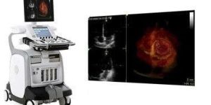 Echocardiogram Machine