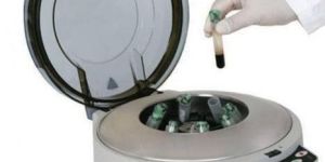 PRP Centrifuge Machine