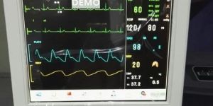 Patient Monitor