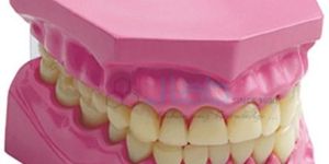 Dental Model