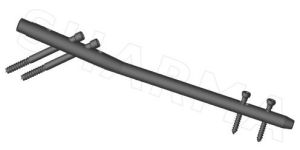 Antegrade Femur Nail