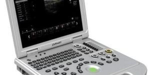 Portable Color Doppler Ultrasound Scanner
