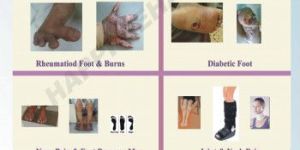 Diabetic Footwear