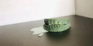 Dental Treatment Services