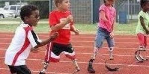 Pediatric Prosthesis