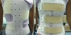 White Scoliosis Brace
