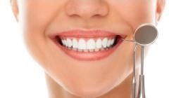 Dental Checkup Services