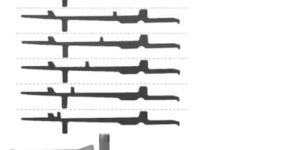 Knitting Machine Parts