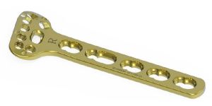 Locking Volar Distal Radius Buttress Plate