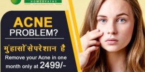 Acne Treatment
