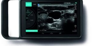 SonoSite Ultrasound Machines