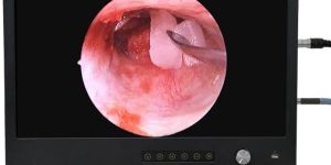 DRMFHD24 FHD Portable Endoscopy Camera